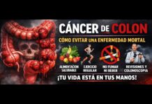 Cáncer de colon, cómo evitar una enfermedad mortal Cáncer colorectal